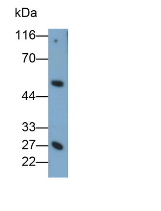 Granzyme K (GZMK) Monoclonal Antibody - image 3