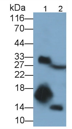 S100 Calcium Binding Protein A9 (S100A9) Polyclonal Antibody - image 2