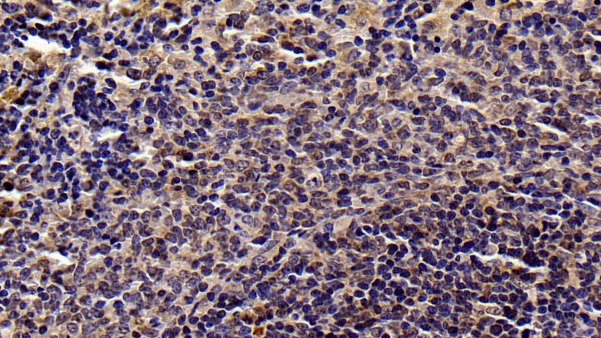 DAB staining on IHC-P; Sample: Rat Pancreas Tissue; Primary Ab: 20ug/ml Mouse Anti-Multi-species STAT3 Antibody; Second Ab: 2ug/mL HRP-Linked Caprine Anti-Mouse IgG Polyclonal Antibody