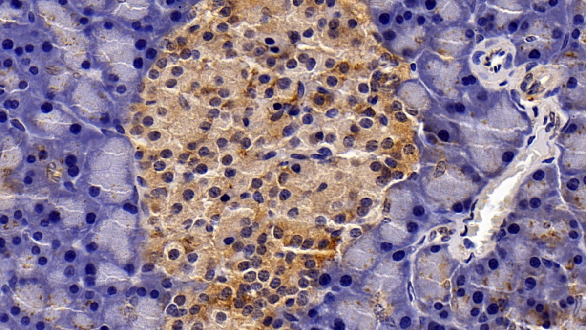 DAB staining on IHC-P; Sample: Rat Liver Tissue; Primary Ab: 20ug/ml Mouse Anti-Multi-species STAT3 Antibody; Second Ab: 2ug/mL HRP-Linked Caprine Anti-Mouse IgG Polyclonal Antibody