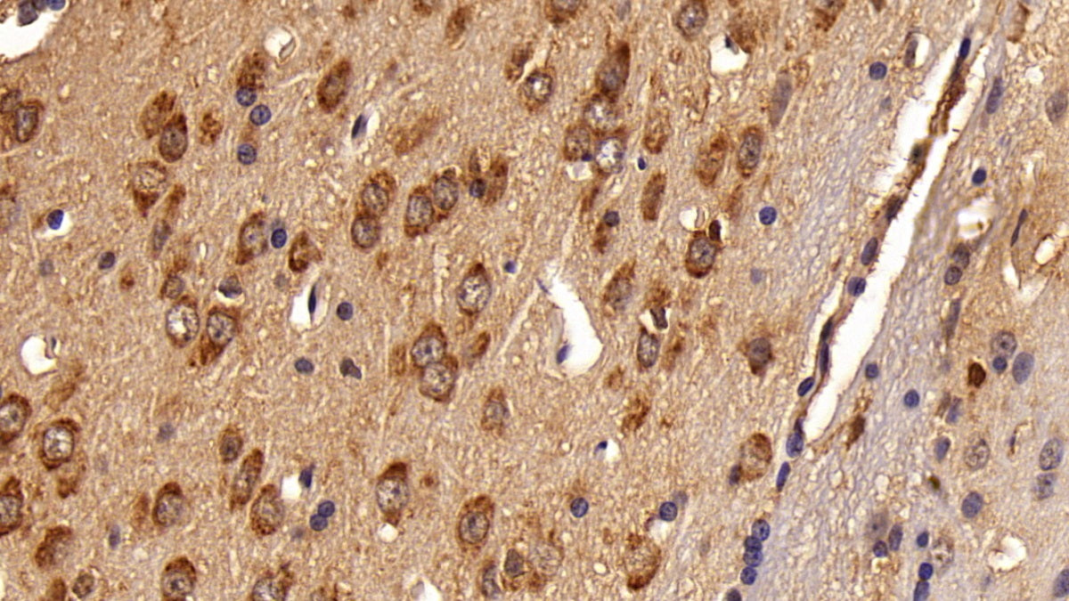 DAB staining on IHC-P; Sample: Rat Kidney Tissue; Primary Ab: 20ug/ml Mouse Anti-Multi-species STAT3 Antibody; Second Ab: 2ug/mL HRP-Linked Caprine Anti-Mouse IgG Polyclonal Antibody