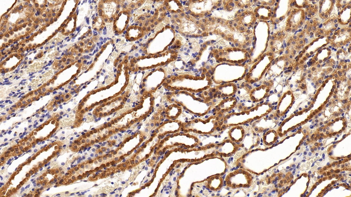 DAB staining on IHC-P; Sample: Rat Liver Tissue; Primary Ab: 20ug/ml Mouse Anti-Multi-species STAT3 Antibody; Second Ab: 2ug/mL HRP-Linked Caprine Anti-Mouse IgG Polyclonal Antibody