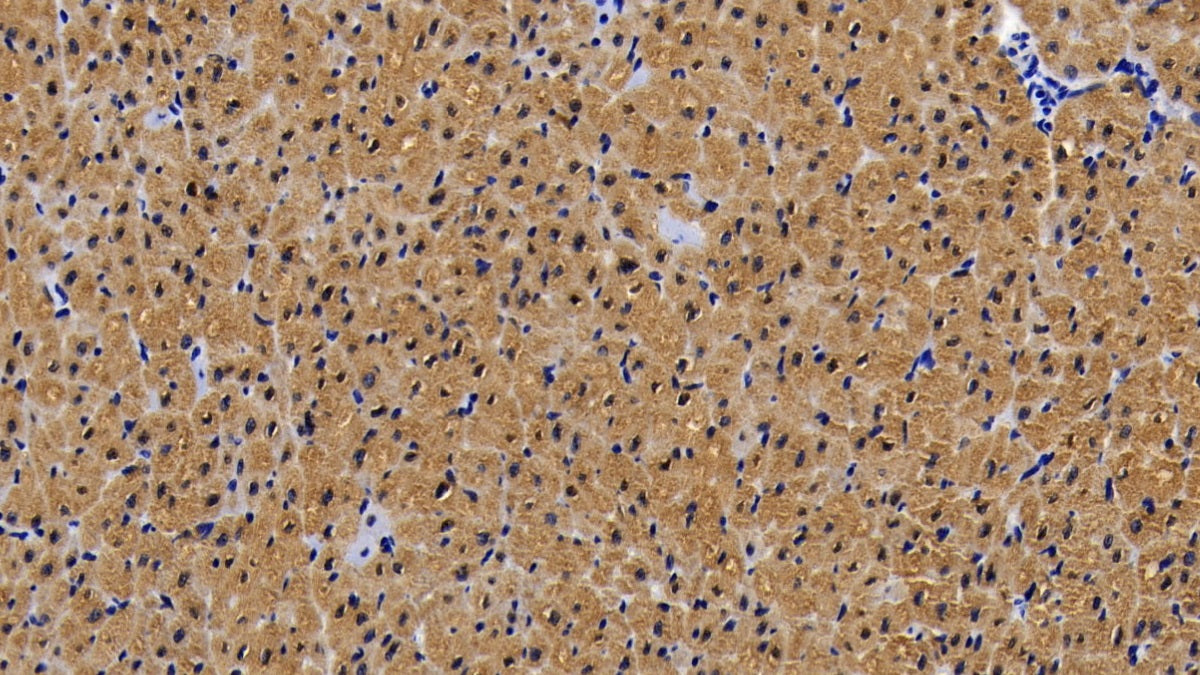 DAB staining on IHC-P; Sample: Porcine Cardiac Muscle Tissue; Primary Ab: 20ug/ml Mouse Anti-Porcine MYO Antibody; Control: Used PBS instead of primary antibody; Second Ab: 2ug/ml HRP-Linked Caprine Anti-Mouse IgG Polyclonal Antibody