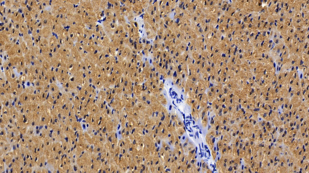 DAB staining on IHC-P; Sample: Porcine Cardiac Muscle Tissue; Primary Ab: 20ug/ml Mouse Anti-Porcine MYO Antibody; Control: Used PBS instead of primary antibody; Second Ab: 2ug/ml HRP-Linked Caprine Anti-Mouse IgG Polyclonal Antibody