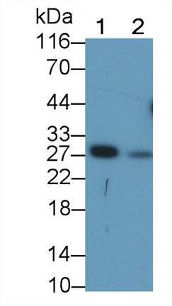 Granzyme K (GZMK) Monoclonal Antibody - image 2