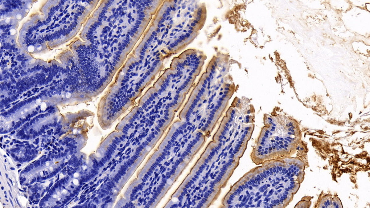 DAB staining on IHC-P; Sample: Mouse Colon Tissue; Primary Ab: 10ug/ml Rabbit Anti-Mouse ACE2 Antibody; Second Ab: 2ug/mL HRP-Linked Caprine Anti-Rabbit IgG Polyclonal Antibody