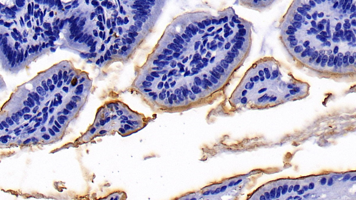 DAB staining on IHC-P; Sample: Mouse Kidney Tissue; Primary Ab: 10ug/ml Rabbit Anti-Mouse ACE2 Antibody; Second Ab: 2ug/mL HRP-Linked Caprine Anti-Rabbit IgG Polyclonal Antibody
