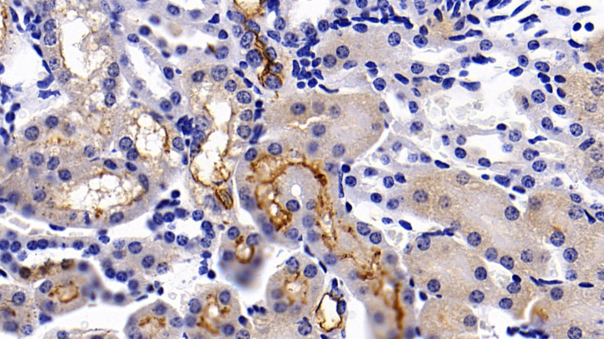 DAB staining on IHC-P; Sample: Mouse Testis Tissue; Primary Ab: 10ug/ml Rabbit Anti-Mouse ACE2 Antibody; Second Ab: 2ug/mL HRP-Linked Caprine Anti-Rabbit IgG Polyclonal Antibody