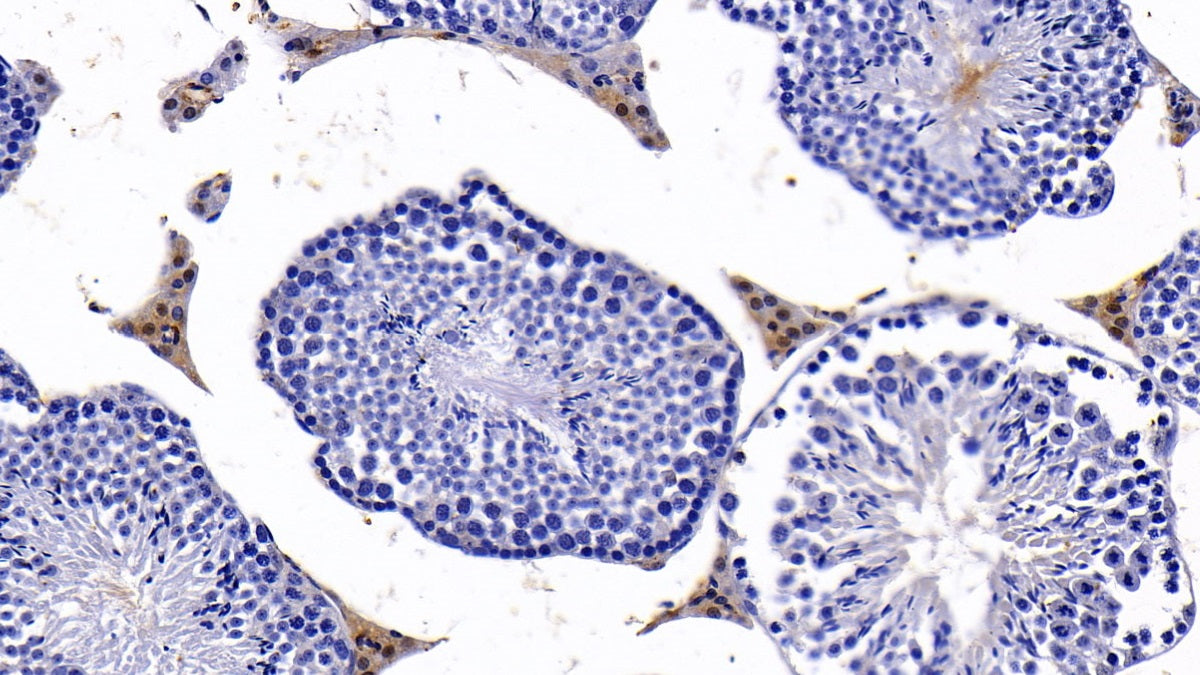 Angiotensin I Converting Enzyme 2 (ACE2) Polyclonal Antibody - image 5