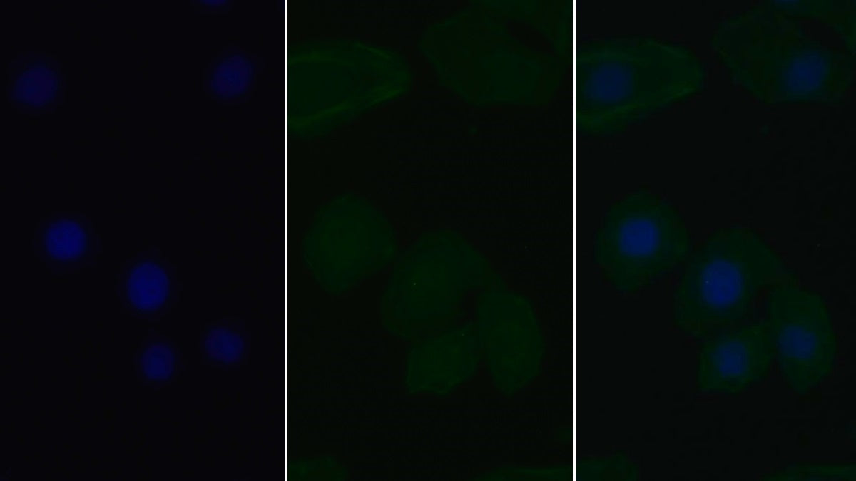 Signal Transducer And Activator Of Transcription 3 (STAT3) Monoclonal Antibody - image 2