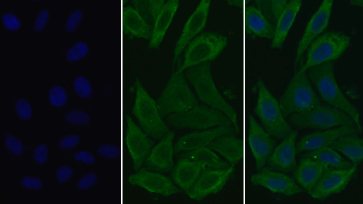 Surfactant Associated Protein D (SPD) Monoclonal Antibody - image 2