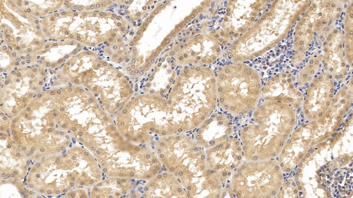 DAB staining on IHC-P; Samples: Human Spleen Tissue; Primary Ab: 30ug/ml Mouse Anti-Human GATA3 Antibody; Second Ab: 2ug/mL HRP-Linked Caprine Anti-Mouse IgG Polyclonal Antibody