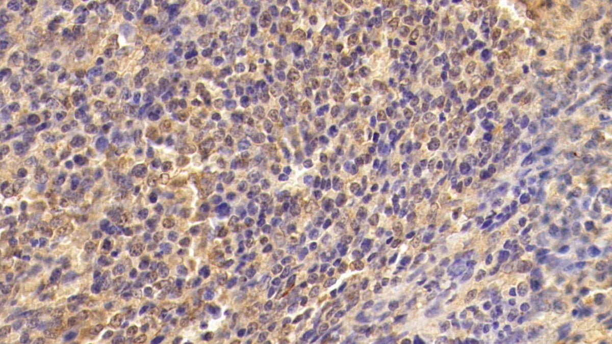 DAB staining on IHC-P; Sample: Human Cerebellum Tissue; Primary Ab: 20ug/ml Mouse Anti-Human TGFb1 Antibody; Second Ab: 2ug/mL HRP-Linked Caprine Anti-Mouse IgG Polyclonal Antibody