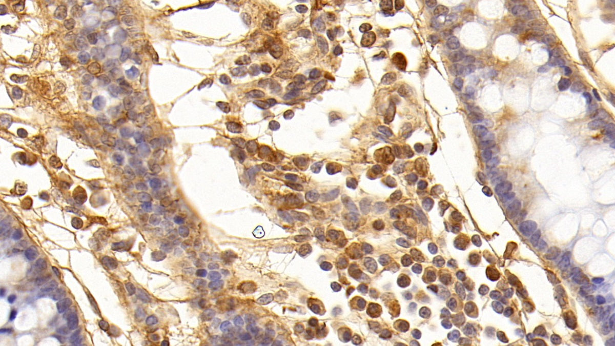 Transforming Growth Factor Beta 1 (TGFb1) Monoclonal Antibody - image 5
