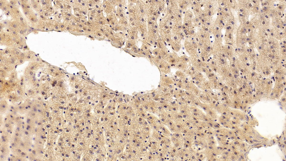 DAB staining on IHC-P; Sample: Human Small intestine Tissue; Primary Ab: 20ug/ml Mouse Anti-Human TGFb1 Antibody; Second Ab: 2ug/mL HRP-Linked Caprine Anti-Mouse IgG Polyclonal Antibody