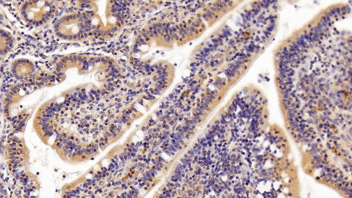 DAB staining on IHC-P; Sample: Human Lymph node Tissue; Primary Ab: 20ug/ml Mouse Anti-Human TGFb1 Antibody; Second Ab: 2ug/mL HRP-Linked Caprine Anti-Mouse IgG Polyclonal Antibody