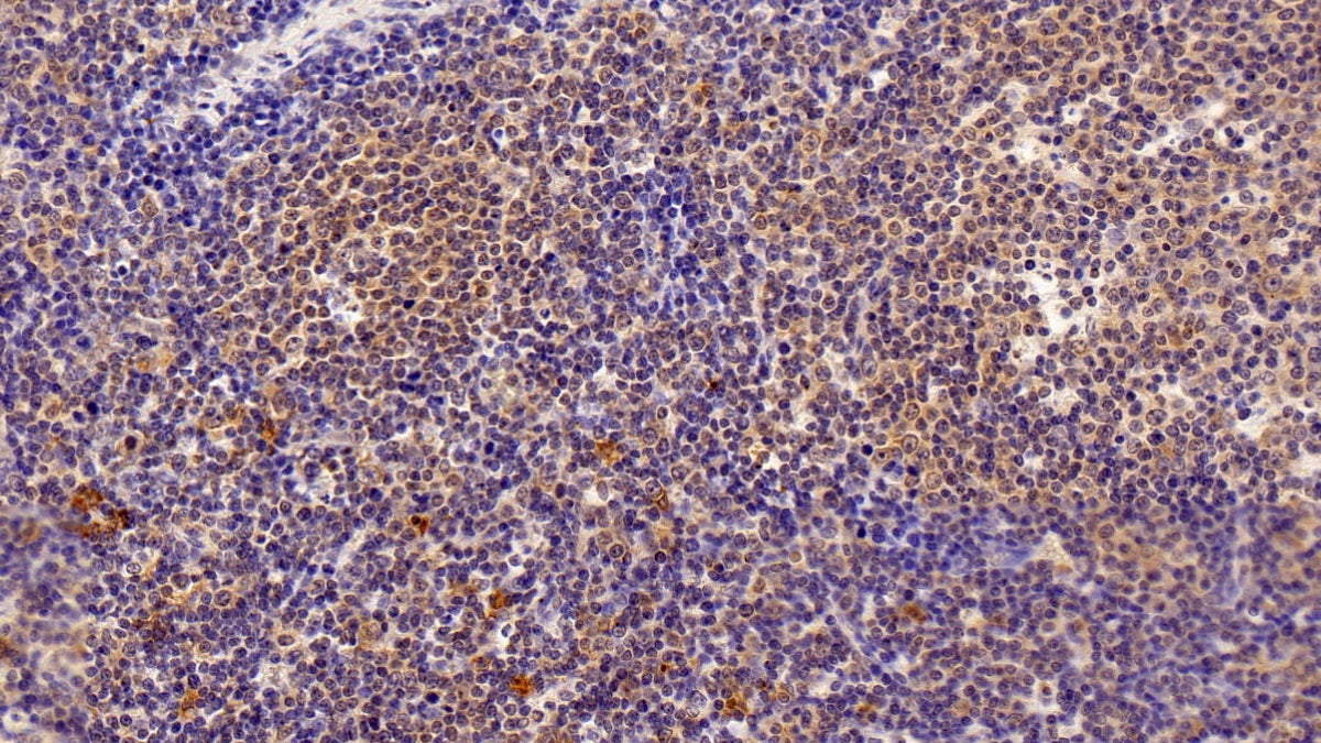 DAB staining on IHC-P; Sample: Human Cerebellum Tissue; Primary Ab: 20ug/ml Mouse Anti-Human TGFb1 Antibody; Second Ab: 2ug/mL HRP-Linked Caprine Anti-Mouse IgG Polyclonal Antibody
