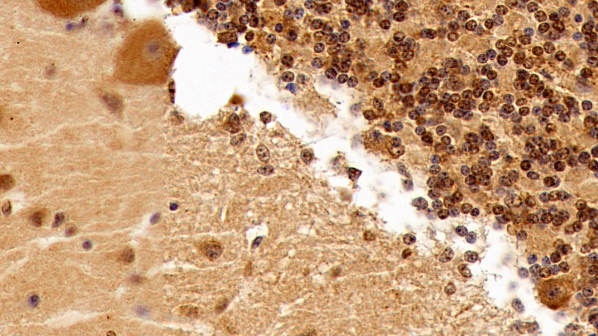 Transforming Growth Factor Beta 1 (TGFb1) Monoclonal Antibody - image 5