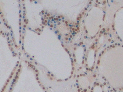 DAB staining on IHC-P; Sample: Human Kidney Tissue; Primary Ab: 10ug/ml Mouse Anti-Human GATA3 Antibody; Second Ab: 2ug/mL HRP-Linked Caprine Anti-Mouse IgG Polyclonal Antibody