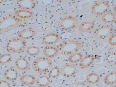 GATA Binding Protein 3 (GATA3) Monoclonal Antibody - image 3