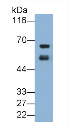 Albumin (ALB) Monoclonal Antibody - image 2