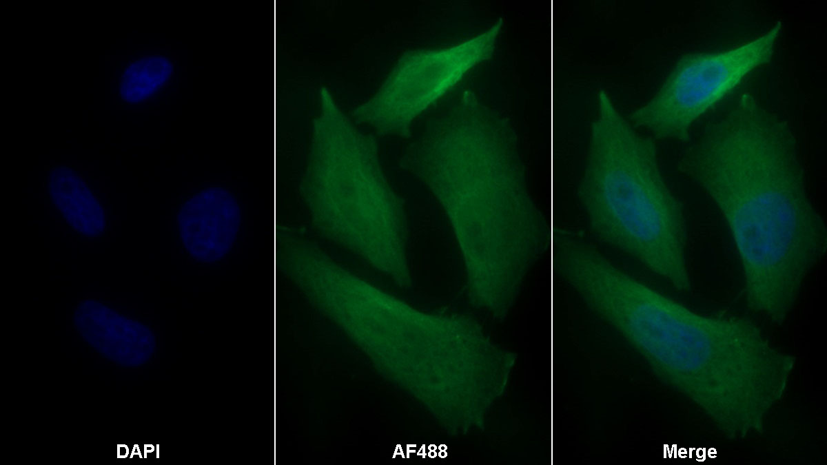 Western Blot; Sample: Lane1: Porcine Liver lysate; Lane2: Rat Liver lysate; Lane3: HepG2 cell lysate Primary Ab: 0.2ug/ml Mouse Anti-Human HPD Antibody Second Ab: 0.2ug/mL HRP-Linked Caprine Anti-Mouse IgG Polyclonal Antibody