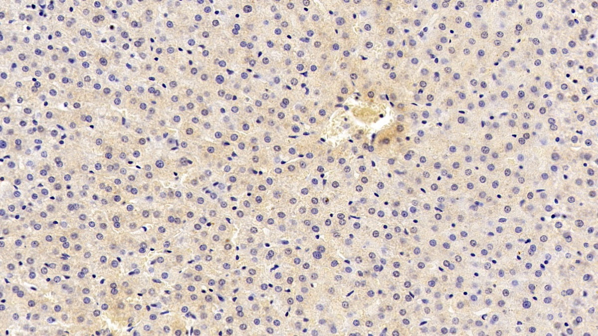 DAB staining on IHC-P; Sample: Human Kidney Tissue; Primary Ab: 30ug/ml Mouse Anti-Human ANTXR2 Antibody; Second Ab: 2ug/mL HRP-Linked Caprine Anti-Mouse IgG Polyclonal Antibody
