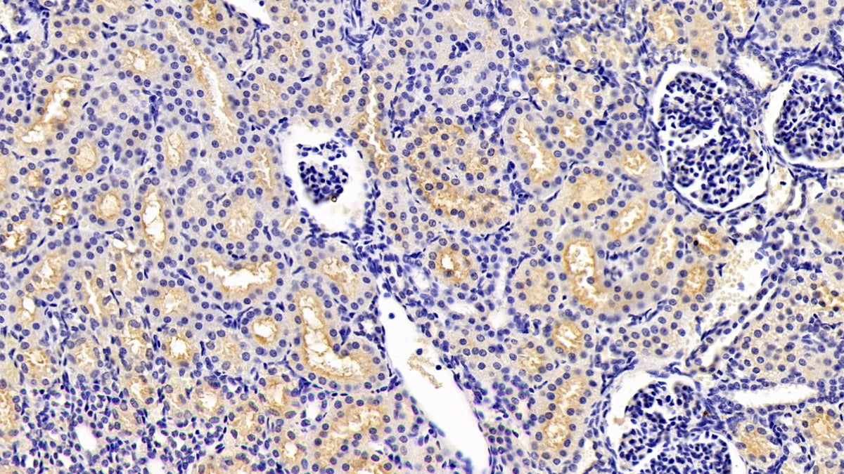 DAB staining on IHC-P; Sample: Human Stomach Tissue; Primary Ab: 30ug/ml Mouse Anti-Human ANTXR2 Antibody; Second Ab: 2ug/mL HRP-Linked Caprine Anti-Mouse IgG Polyclonal Antibody