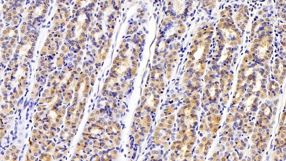 Anthrax Toxin Receptor 2 (ANTXR2) Monoclonal Antibody - image 4