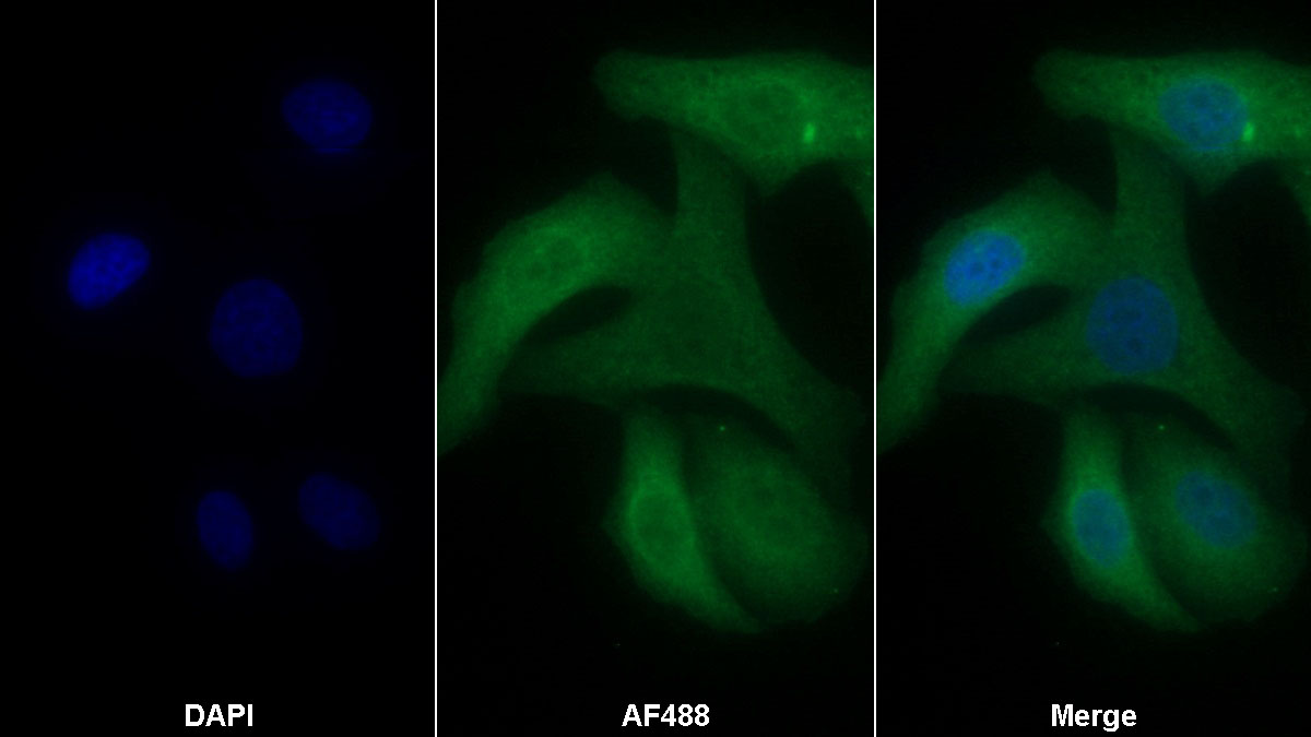 Western Blot; Sample: Lane1: Porcine Testis lysate; Lane2: Hela cell lysate; Lane3: U2OS cell lysate Primary Ab: 0.3ug/ml Mouse Anti-Human CCT2 Antibody Second Ab: 0.2ug/mL HRP-Linked Caprine Anti-Mouse IgG Polyclonal Antibody