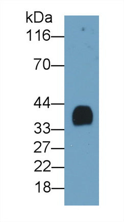 Plasminogen Activator, Urokinase Receptor (uPAR) Polyclonal Antibody - image 2