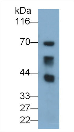 Chemokine C-C-Motif Receptor 10 (CCR10) Polyclonal Antibody - image 2