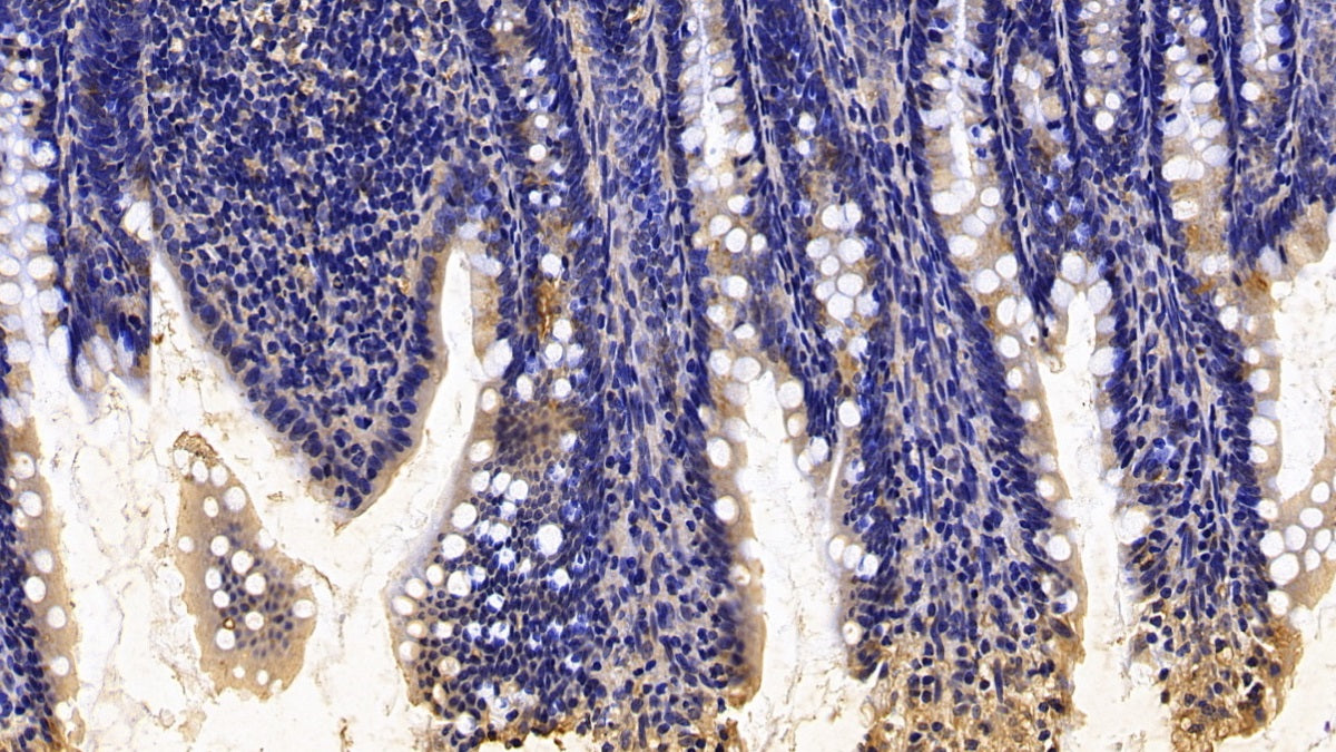 DAB staining on IHC-P; Sample: Rat Cardiac Muscle Tissue; Primary Ab: 30ug/ml Mouse Anti-Rat CALR Antibody; Second Ab: 2ug/mL HRP-Linked Caprine Anti-Mouse IgG Polyclonal Antibody