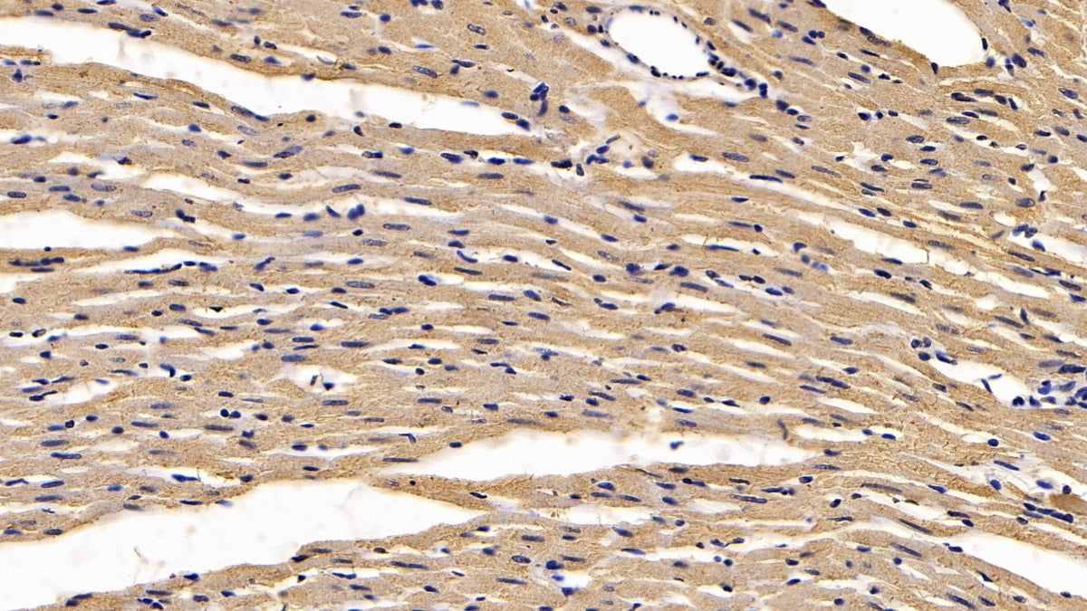 DAB staining on IHC-P; Sample: Rat Testis Tissue; Primary Ab: 30ug/ml Mouse Anti-Rat CALR Antibody; Second Ab: 2ug/mL HRP-Linked Caprine Anti-Mouse IgG Polyclonal Antibody