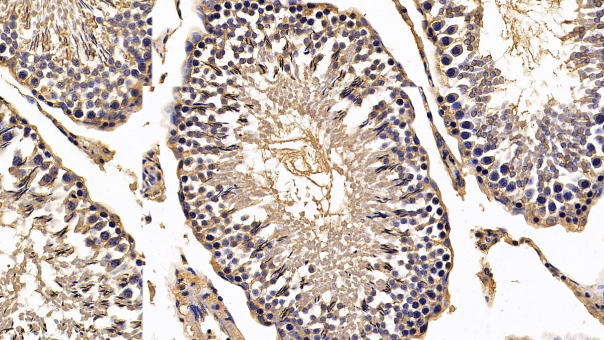 DAB staining on IHC-P; Sample: Rat Liver Tissue; Primary Ab: 30ug/ml Mouse Anti-Rat CALR Antibody; Second Ab: 2ug/mL HRP-Linked Caprine Anti-Mouse IgG Polyclonal Antibody