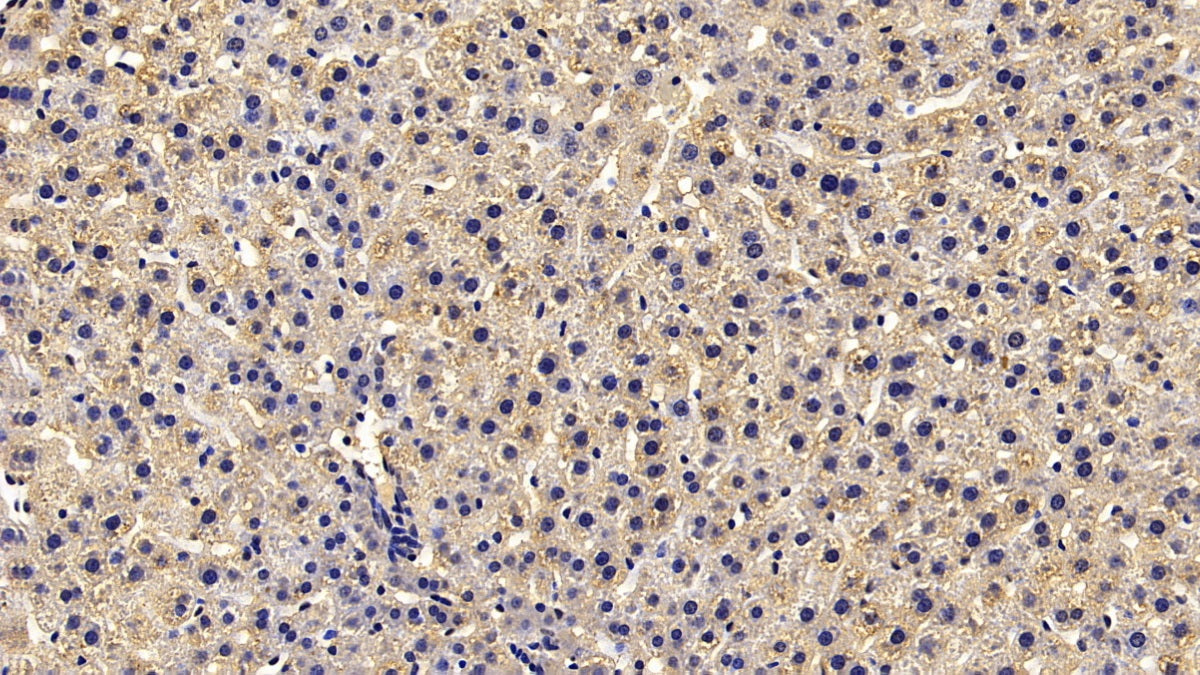 Calreticulin (CALR) Monoclonal Antibody - image 5