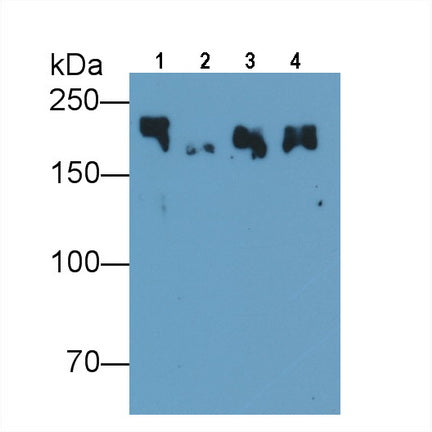 Myosin Heavy Chain 8, Skeletal Muscle, Perinatal (MYH8) Monoclonal Antibody - image 3