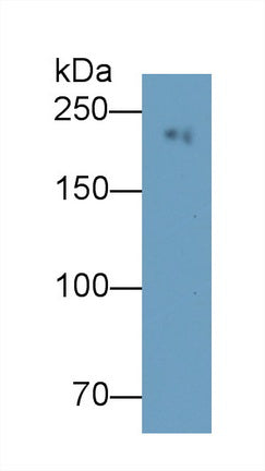 Myosin Heavy Chain 8, Skeletal Muscle, Perinatal (MYH8) Monoclonal Antibody - image 3
