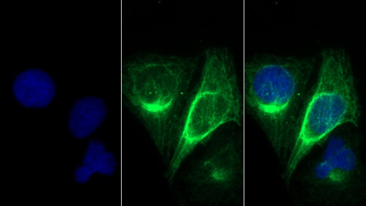 Western Blot; Sample: Lane1: Rat Skeletal muscle lysate; Lane2: Mouse Skeletal muscle lysate Primary Ab: 0.01ug/ml Mouse Anti-Human MYH8 Antibody Second Ab: 0.2ug/mL HRP-Linked Caprine Anti-Mouse IgG Polyclonal Antibody