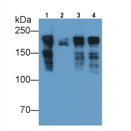 Myosin Heavy Chain 8, Skeletal Muscle, Perinatal (MYH8) Monoclonal Antibody - image 3
