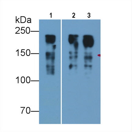 Myosin Heavy Chain 8, Skeletal Muscle, Perinatal (MYH8) Monoclonal Antibody - image 3