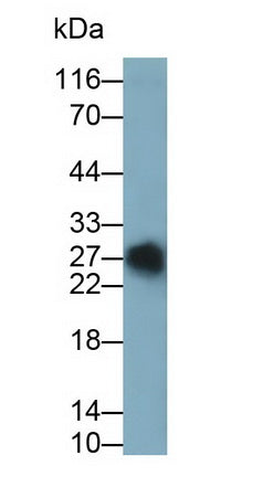 T-Cell Surface Glycoprotein CD3 Gamma (CD3g) Monoclonal Antibody - image 2