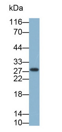 Western Blot; Sample: Lane1: Porcine Cerebrum lysate; Lane2: HepG2 cell lysate; Primary Ab: 0.3ug/ml Mouse Anti-Human EPDR1 Antibody; Second Ab: 0.2ug/mL HRP-Linked Caprine Anti-Mouse IgG Polyclonal Antibody