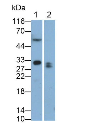 Ependymin Related Protein 1 (EPDR1) Monoclonal Antibody - image 3