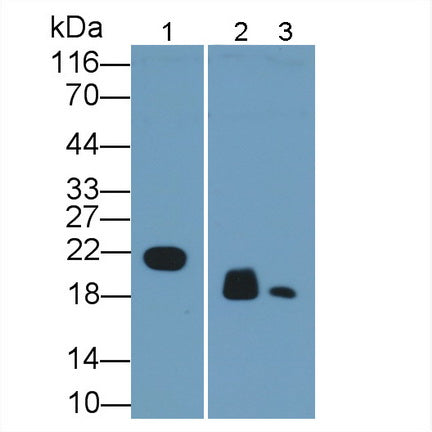 Retinol Binding Protein 4 (RBP4) Monoclonal Antibody - image 2