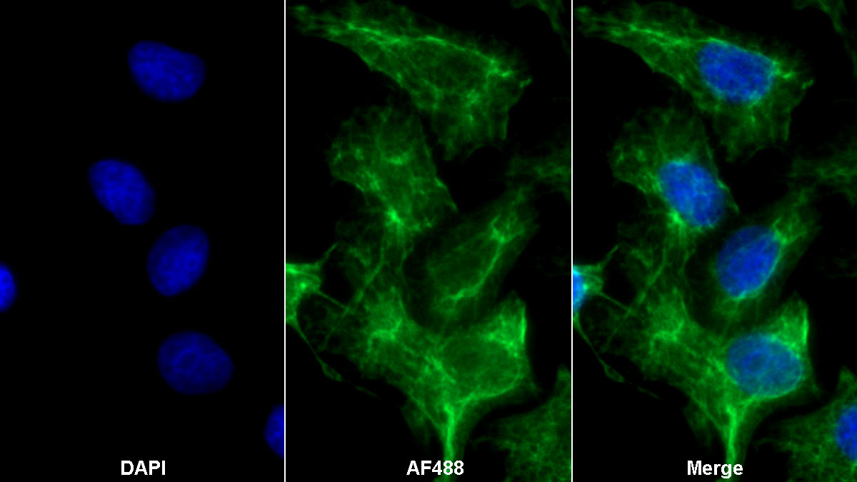 Western Blot; Sample: A431 cell lysate Primary Ab: 0.5ug/ml Mouse Anti-Human CK10 Antibody Second Ab: 0.2ug/mL HRP-Linked Caprine Anti-Mouse IgG Polyclonal Antibody