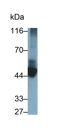Cytokeratin 10 (CK10) Monoclonal Antibody - image 3