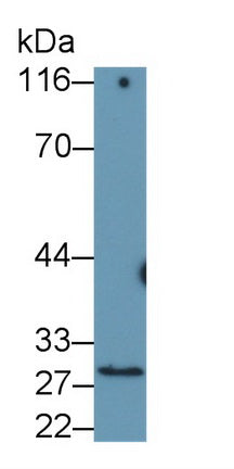 Western Blot; Sample: Lane1: Rat Liver lysate; Lane2: Rat Kidney lysate; Lane3: 293T cell lysate; Primary Ab: 0.3ug/ml Mouse Anti-Rat COMT Antibody; Second Ab: 0.2ug/mL HRP-Linked Caprine Anti-Mouse IgG Polyclonal Antibody