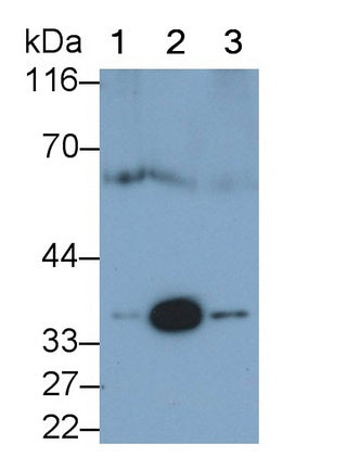 Catechol-O-Methyltransferase (COMT) Monoclonal Antibody - image 3