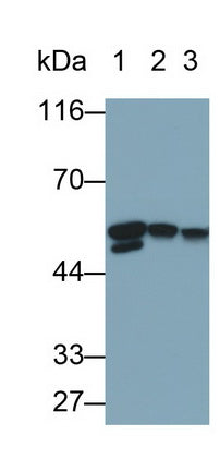 Desmin (Des) Monoclonal Antibody - image 2